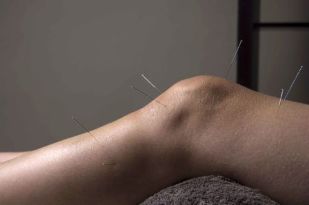 Az akupunktúra elősegíti az ízületi szövetek helyreállítását